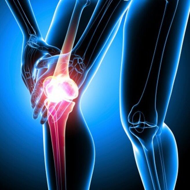 Advanced stage rheumatoid arthritis can cause hip pain